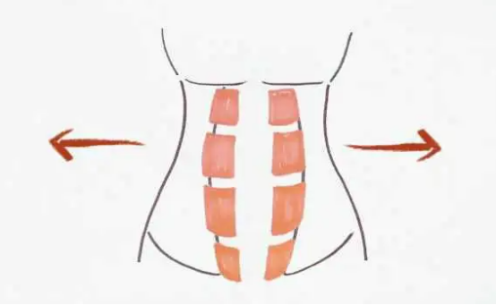  产后腹直肌分离有必要修复吗，要怎么修复？