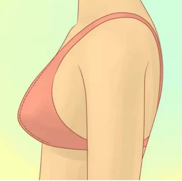 产后胸部下垂整形手术怎么做