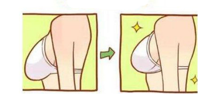  产后如何丰胸整形